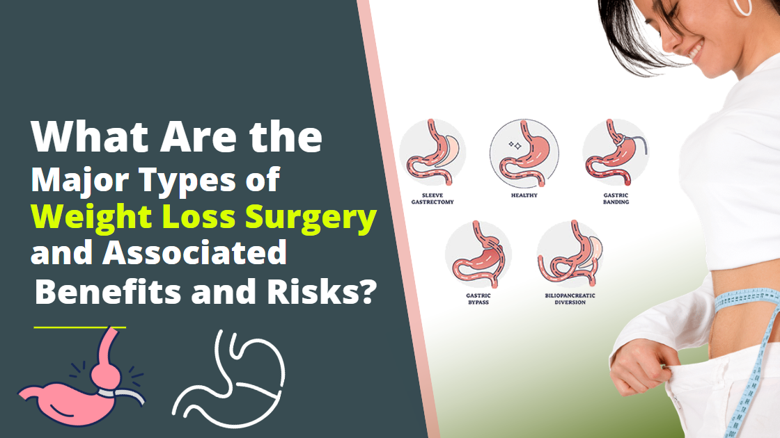 What Are The Major Types Of Weight Loss Surgery And Associated Benefits And Risks Weight Loss 