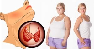 How to Lose Weight with Hypothyroidism