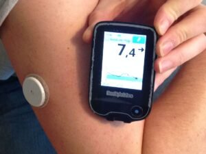 Examining CGM's advantages for Type 1 and Type 2 diabetes